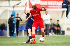 MIC22_U16_LIVER_APFC_AF_007